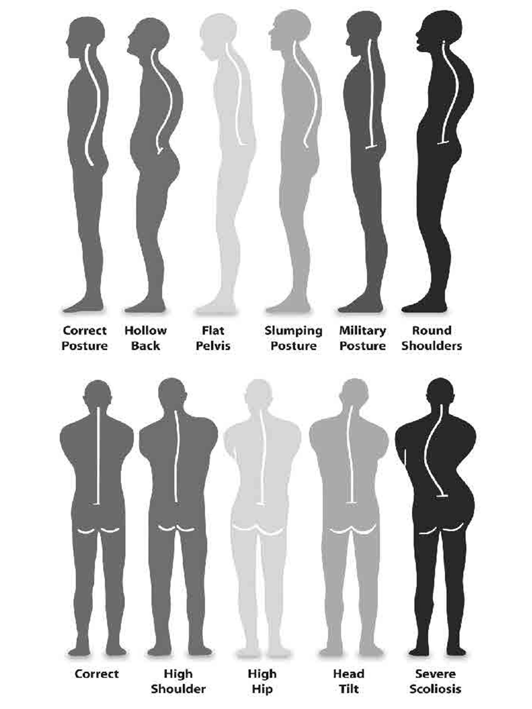 diagram of different postures from back and side views